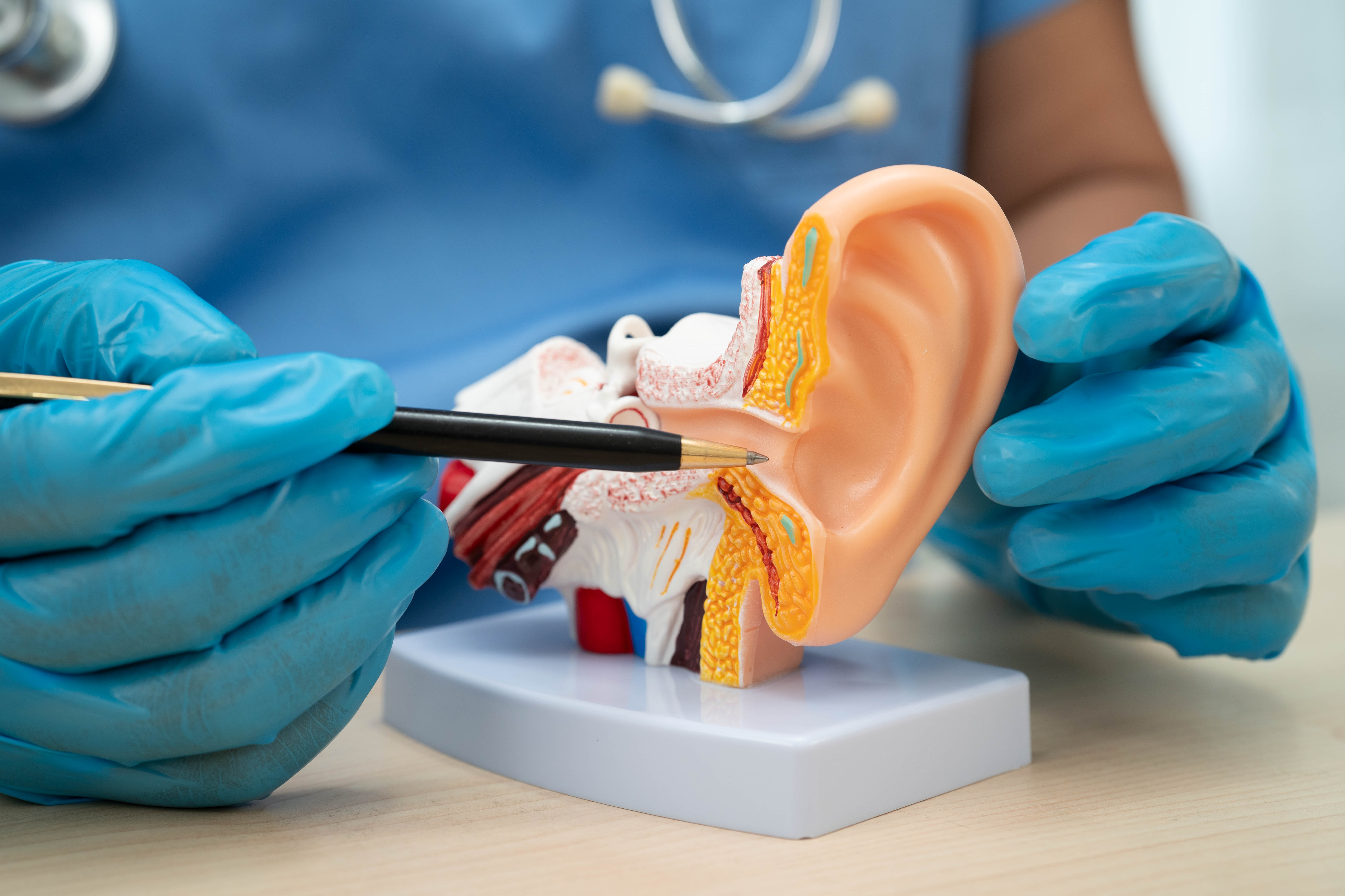 Schéma auriculaire
